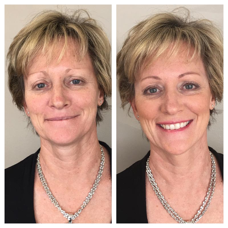 TIM Makeup Before and After