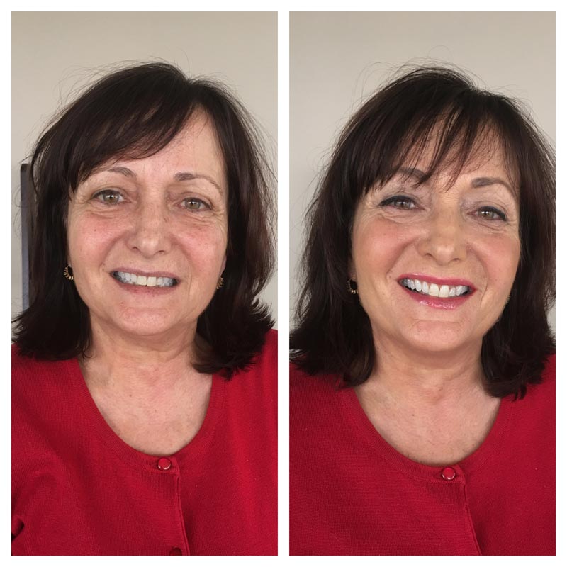 TIM Makeup Before and After