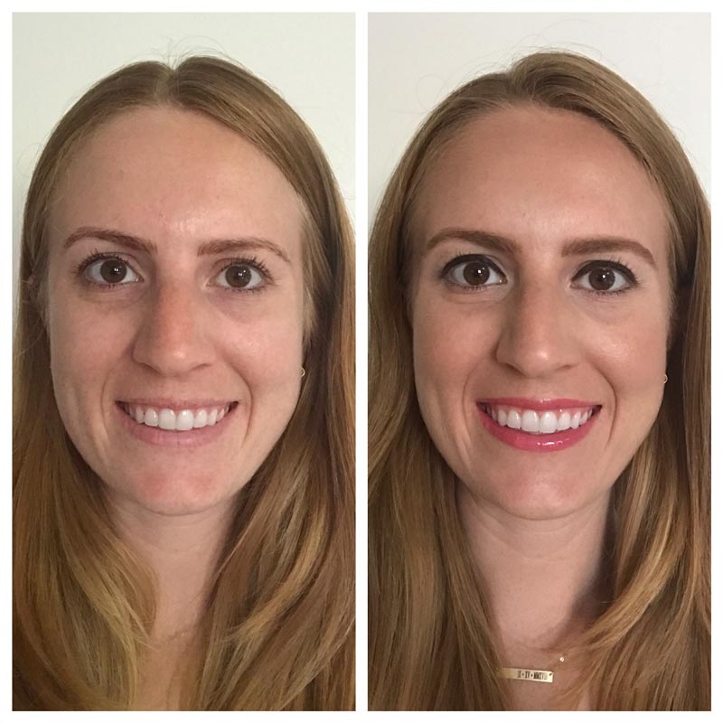 TIM Makeup Before and After