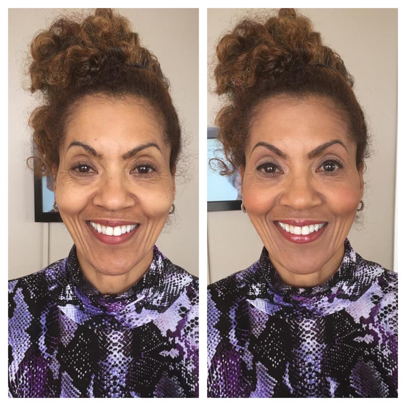 TIM Makeup Before and After