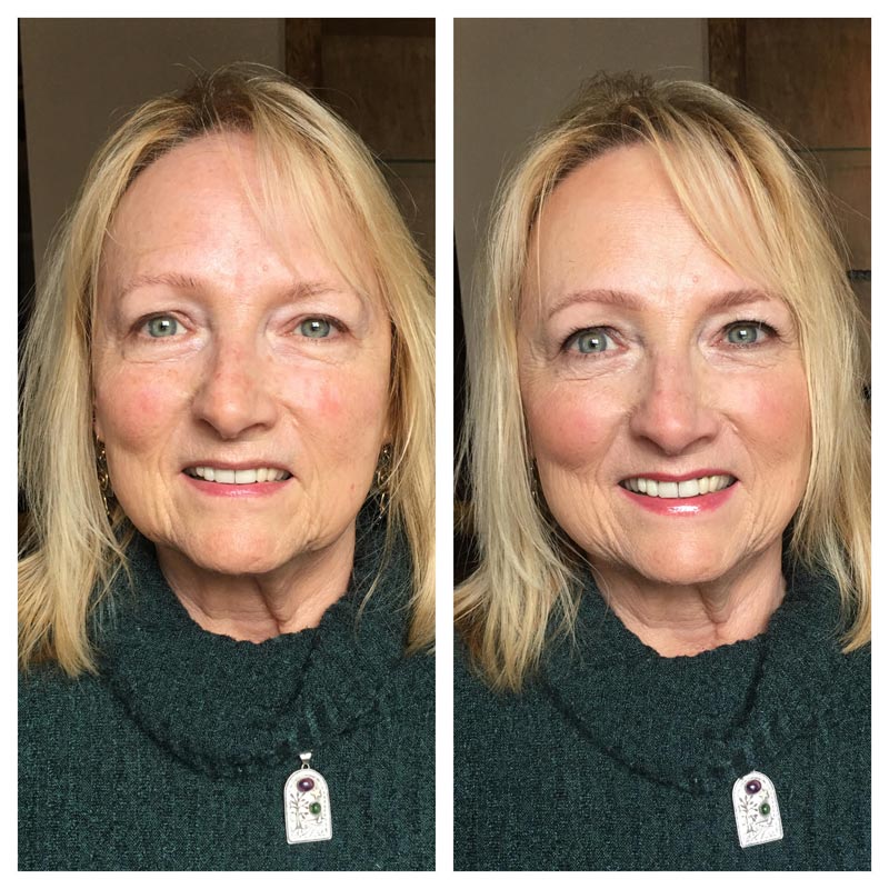 TIM Makeup Before and After