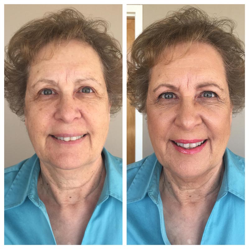 TIM Makeup Before and After